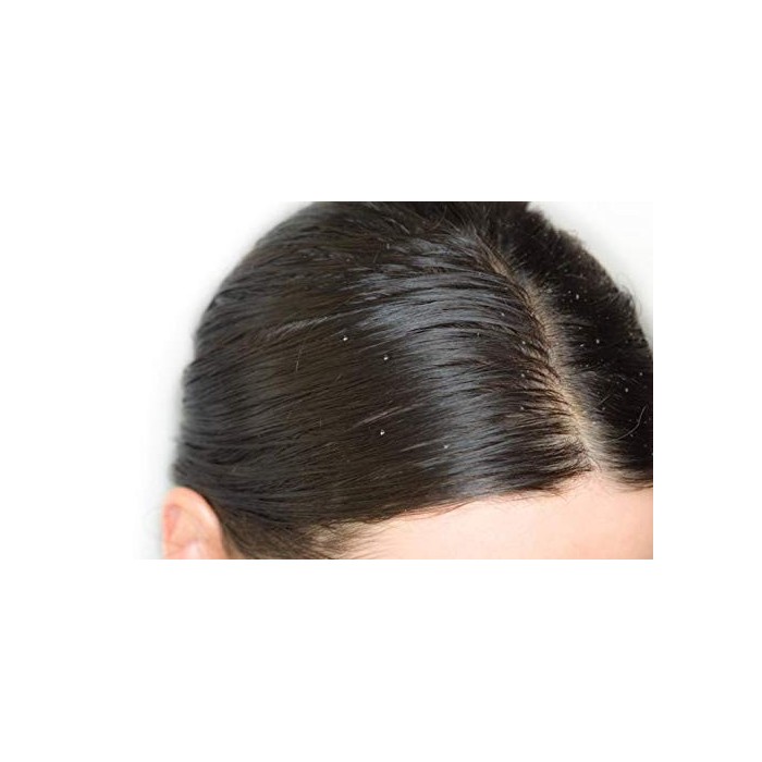 Aromatherapy Anti Dandruff Shampoo with Anti Dandruff Properties