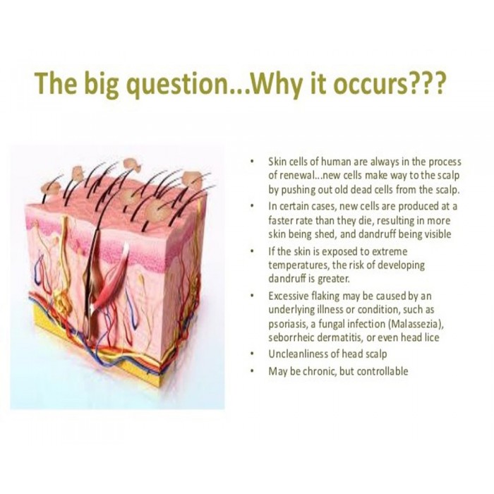 Aromatherapy Ant-Dandruff Hair Oil, 1 pack (1 X 200 ml)