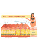 Anti cellulite Cream | weight loss | ecoplanetstore.com