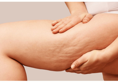 Ecoplanet Aromatherapy Massage Oil for Cellulite: Enhancing Your Skincare Routine Naturally