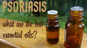 essential oils for psoriasis